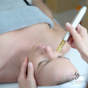 Dermapen Microneedling